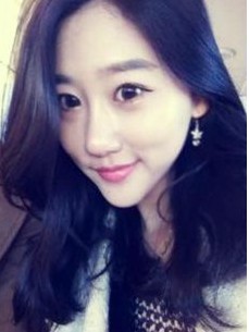 　做完双眼皮手术4个月后样子