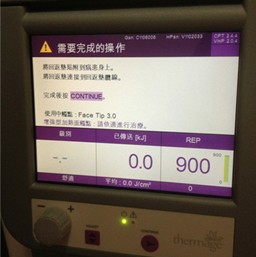 把探头装上去后开始治疗