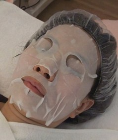 治疗完毕敷面膜镇定皮肤