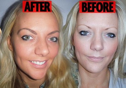 英女子花4千英镑做眉毛种植 术后感叹应珍惜眉毛