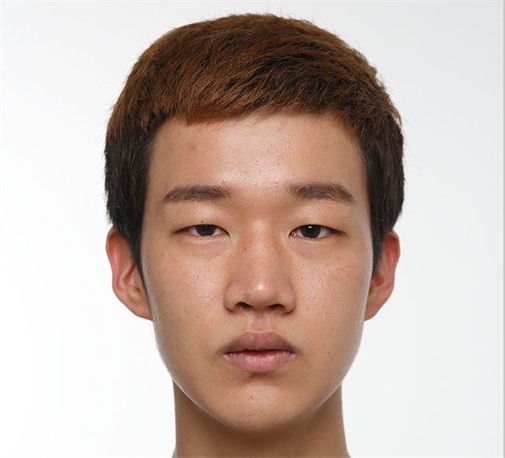 双眼皮 开眼角 定制隆鼻 隆下颏