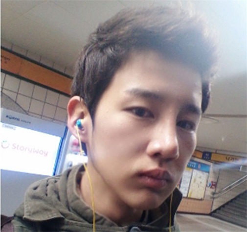 双眼皮 开眼角 定制隆鼻 隆下颏