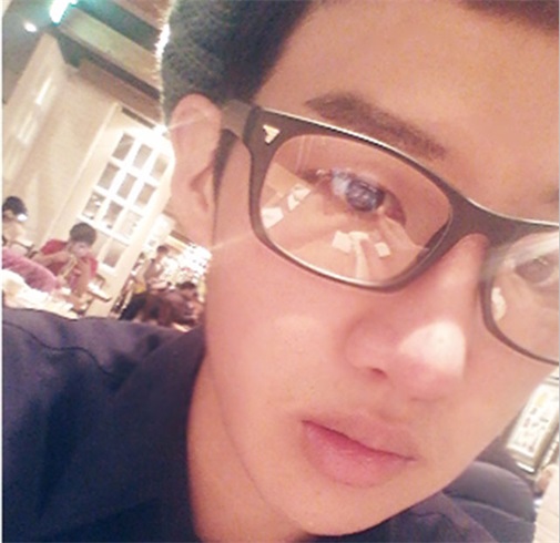 双眼皮 开眼角 定制隆鼻 隆下颏