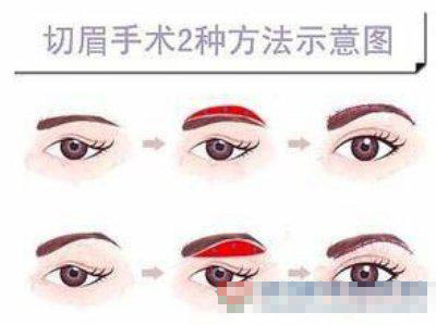 切眉方式