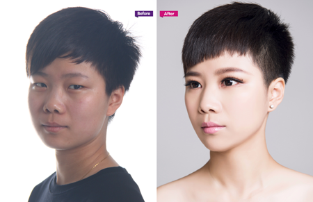 割双眼皮+开内眼角 “假小子”焱焱成功蜕变