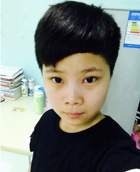 割双眼皮+开内眼角 “假小子”焱焱成功蜕变