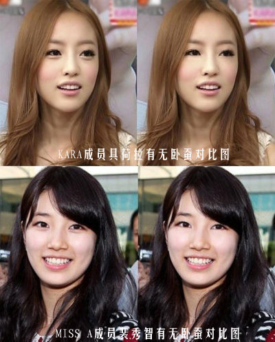 韩国明星有无卧蚕的对比图