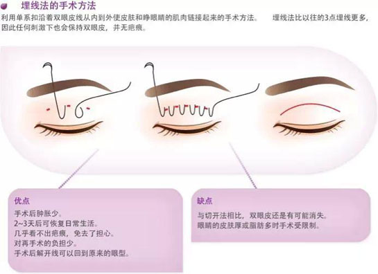 什么是开眼角？