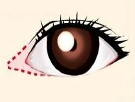 开眼角能让眼睛更大更明亮