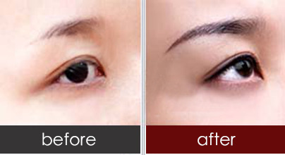 半永久纹眉效果对比图