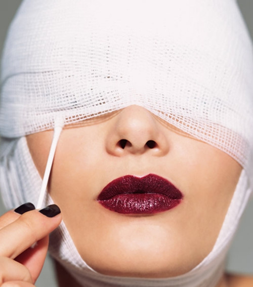 切开双眼皮的恢复情况