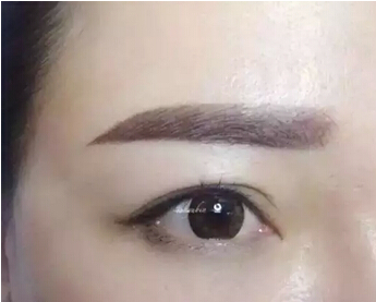 雾状眉的适应症