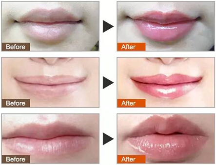 韩式半永久果冻唇前后对比图