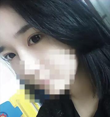 埋线双眼皮恢复过程