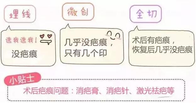 韩式双眼皮优点