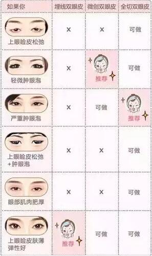 韩式双眼皮适合人群