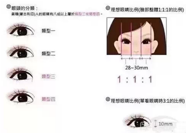 割双眼皮开眼角