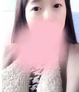 埋线双眼皮图片 真人案例讲解恢复过程