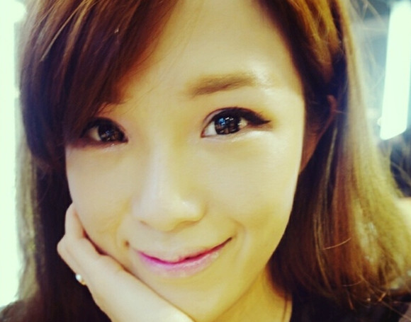 切开双眼皮术后第12天