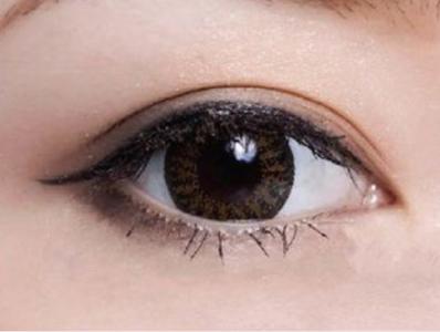 韩式双眼皮有几种手术方法？