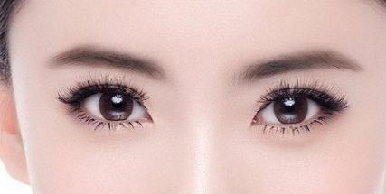 韩式双眼皮的适应症,双眼皮手术,上睑皮肤松弛,内双眼皮