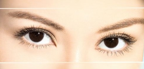 韩式双眼皮手术后的护理,韩式双眼皮的效果