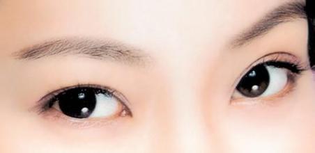 成都韩式双眼皮的费用,双眼皮手术