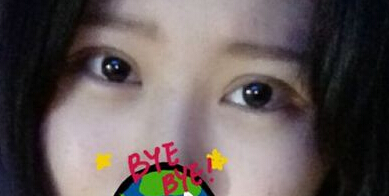 妹子分享：看我的韩式双眼皮前后对比如何？